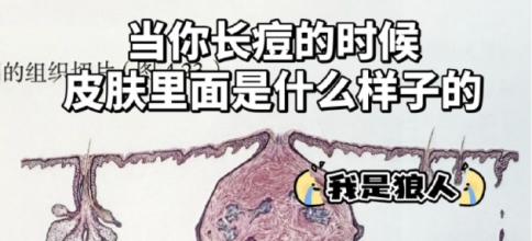 皮肤爆痘留印又留坑的真相